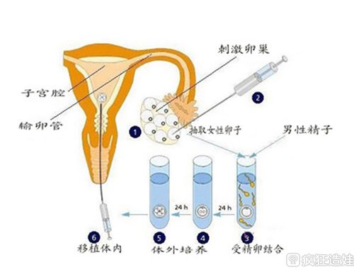 杭州省有人试管代怀吗成功率最高的医院
