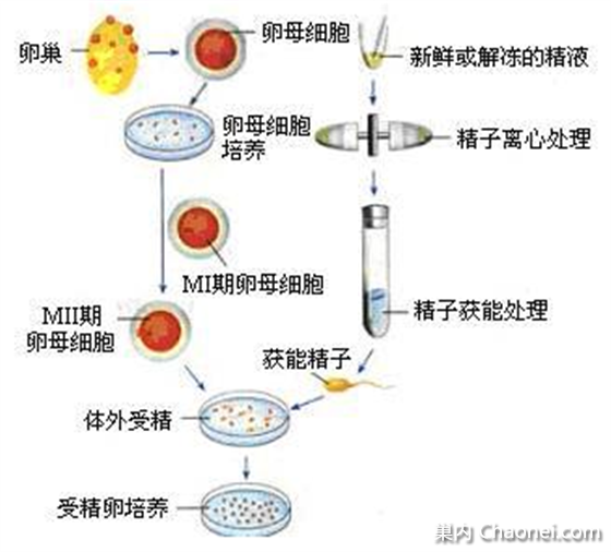 试管代怀哪做得好减胎术大概多少钱？