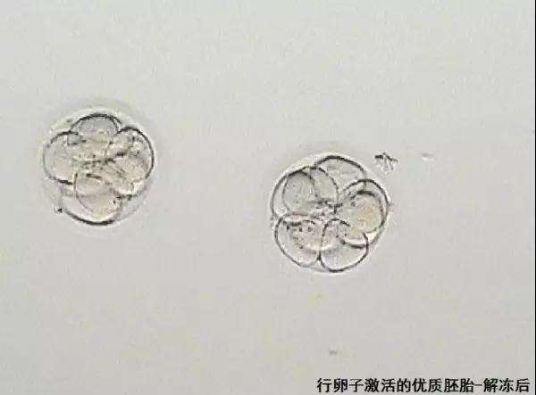 2023年杭州国内代怀咨询医院排名公布,哪家医院好一清二楚!